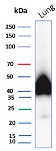 Podoplanin Antibody (PDPN/8950R) Western Blot: Podoplanin Antibody (PDPN/8950R) [NBP3-23709] -