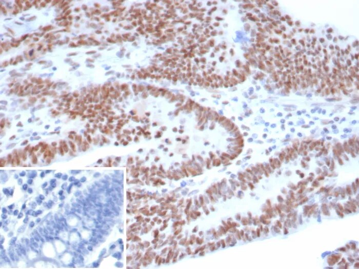 p53 Antibody (TP53/8183R) Immunohistochemistry-Paraffin: p53 Antibody (TP53/8183R) [NBP3-23712] -