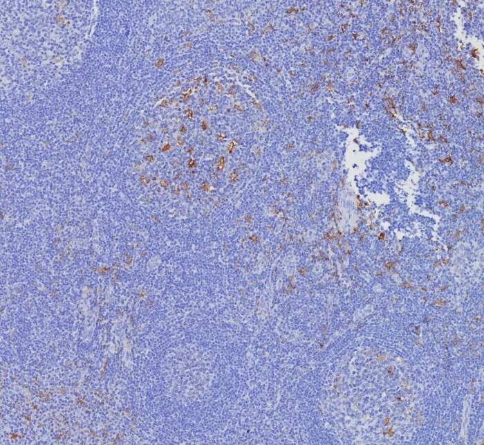 CD163L1 Antibody (CD163L1/7972) Immunohistochemistry-Paraffin: CD163L1 Antibody (CD163L1/7972) [NBP3-23716] -