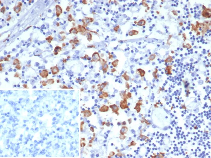 CD163L1 Antibody (CD163L1/7974) Immunohistochemistry-Paraffin: CD163L1 Antibody (CD163L1/7974) [NBP3-23717] -