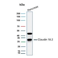 Claudin-18.2 Antibody (CLDN18.2/8559R) Western Blot: Claudin-18.2 Antibody (CLDN18.2/8559R) [NBP3-23718] -