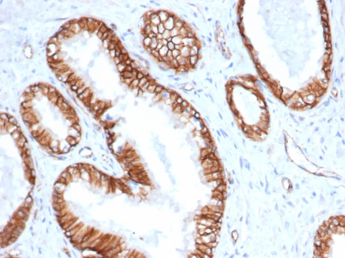 beta-Catenin Antibody (CTNNB1/6807R)