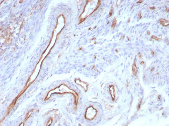 CD31/PECAM-1 Antibody (rPECAM1/8830)