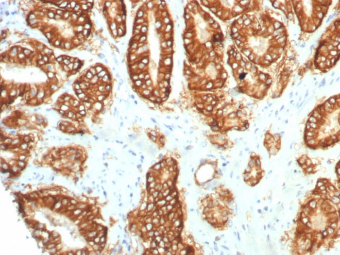 TROP-2 Antibody (TACSTD2/7349R)