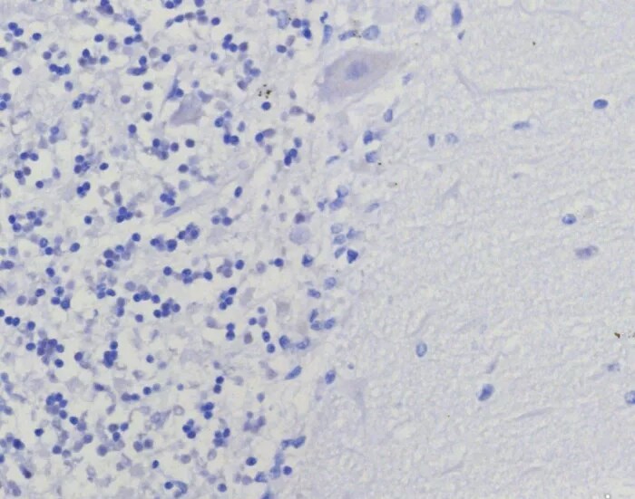 Thymidylate Synthase Antibody (TYMS/9091R) Immunohistochemistry-Paraffin: Thymidylate Synthase Antibody (TYMS/9091R) [NBP3-23732] -