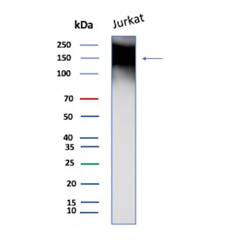TAG-72 Antibody (TAG72/8317R) Western Blot: TAG-72 Antibody (TAG72/8317R) [NBP3-23734] -