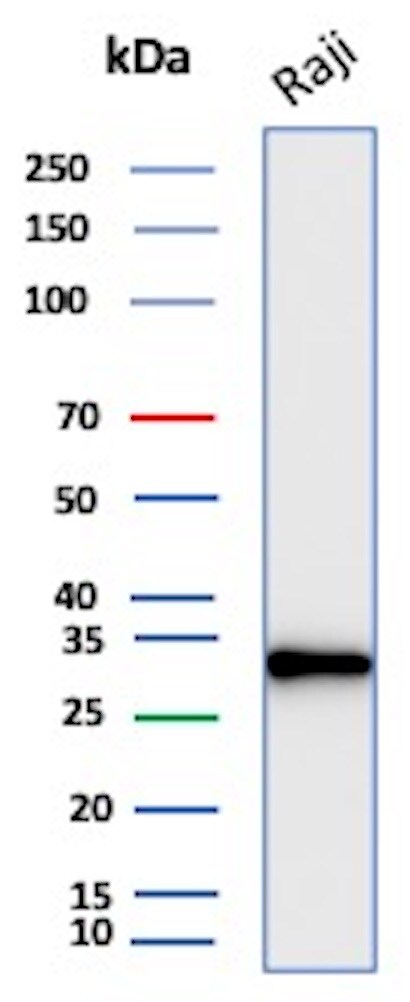 CD20 Antibody (rMS4A1/8044) Western Blot: CD20 Antibody (rMS4A1/8044) [NBP3-23744] -