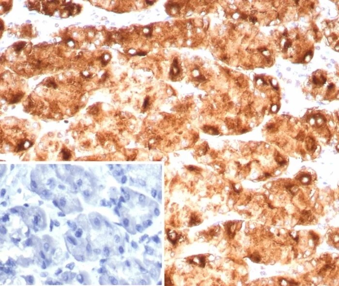 Lewis Y Antibody (LWY/9243R) Immunohistochemistry-Paraffin: Lewis Y Antibody (LWY/9243R) [NBP3-23755] -