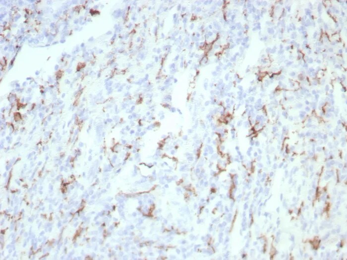 CD163 Antibody (rM130/8823) Immunohistochemistry-Paraffin: CD163 Antibody (rM130/8823) [NBP3-23756] -