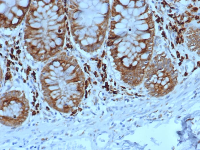ALDH1L1 Antibody (ALDH1L1/7702)