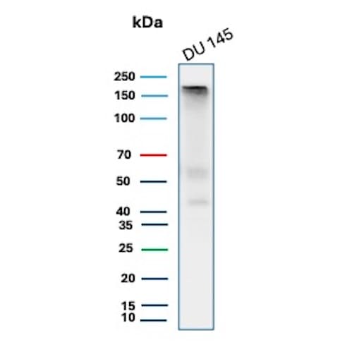 MSH6 Antibody (MSH6/8338R) Western Blot: MSH6 Antibody (MSH6/8338R) [NBP3-23764] -