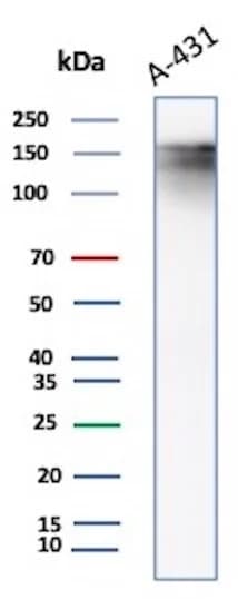 EGFR Antibody (EGFR/8933R) Western Blot: EGFR Antibody (EGFR/8933R) [NBP3-23766] -