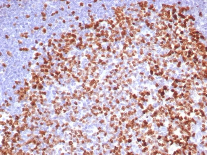 Ki67/MKI67 Antibody (MKI67/8315R) Immunohistochemistry-Paraffin: Ki67/MKI67 Antibody (MKI67/8315R) [NBP3-23770] -