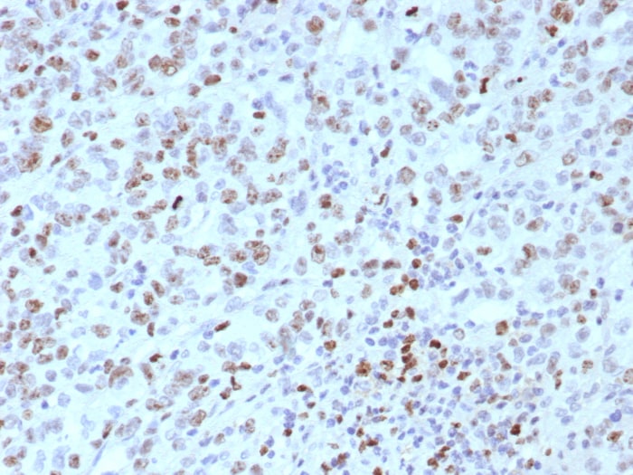 MLH1 Antibody (rMLH1/8630)