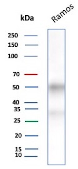 CD27/TNFRSF7 Antibody (LPFS2/8607R) Western Blot: CD27/TNFRSF7 Antibody (LPFS2/8607R) [NBP3-23776] -