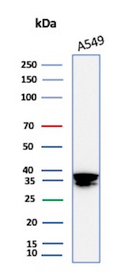 Annexin A1 Antibody (rANXA1/6451) Western Blot: Annexin A1 Antibody (rANXA1/6451) [NBP3-23779] -