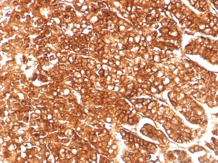 MDR1/ABCB1 Antibody (MDR1/8986R)