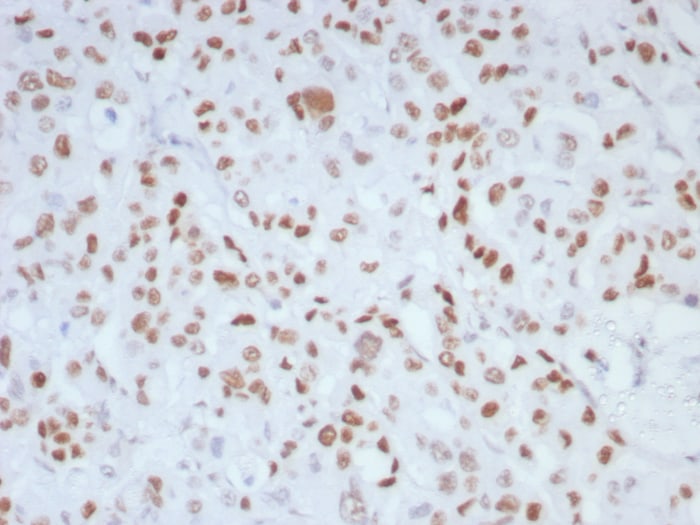 MLH1 Antibody (MLH1/8855R)