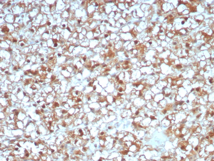 ALDH1L1 Antibody (ALDH1L1/7969)