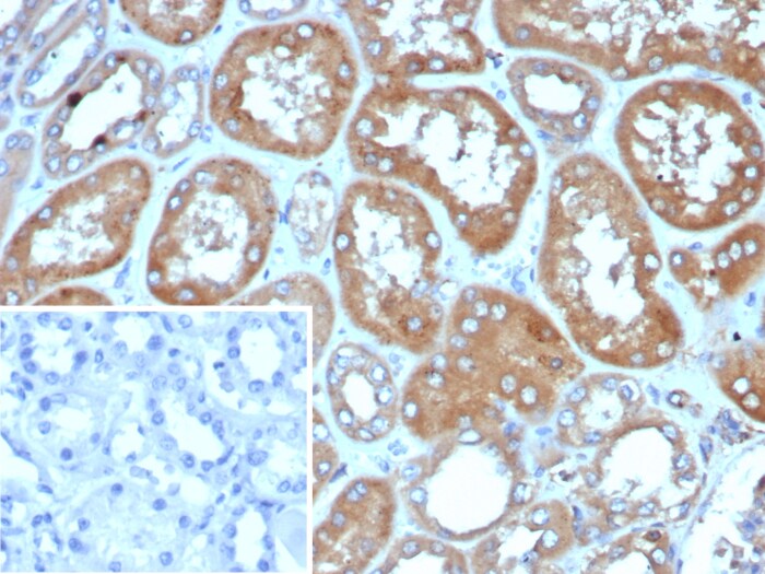 RHOBTB2 Antibody (DBC2/4570)