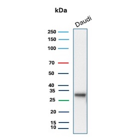 HLA DQ/DR/DP Antibody (HLA-Pan/8622R) Western Blot: HLA DQ/DR/DP Antibody (HLA-Pan/8622R) [NBP3-23793] -