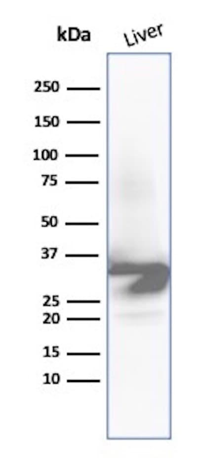 ICAM-1/CD54 Antibody (ICAM1/9379R) Western Blot: ICAM-1/CD54 Antibody (ICAM1/9379R) [NBP3-23796] -