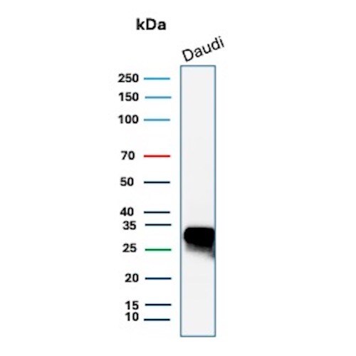HLA DQ/DR/DP Antibody (HLA-Pan/9268R) Western Blot: HLA DQ/DR/DP Antibody (HLA-Pan/9268R) [NBP3-23800] -
