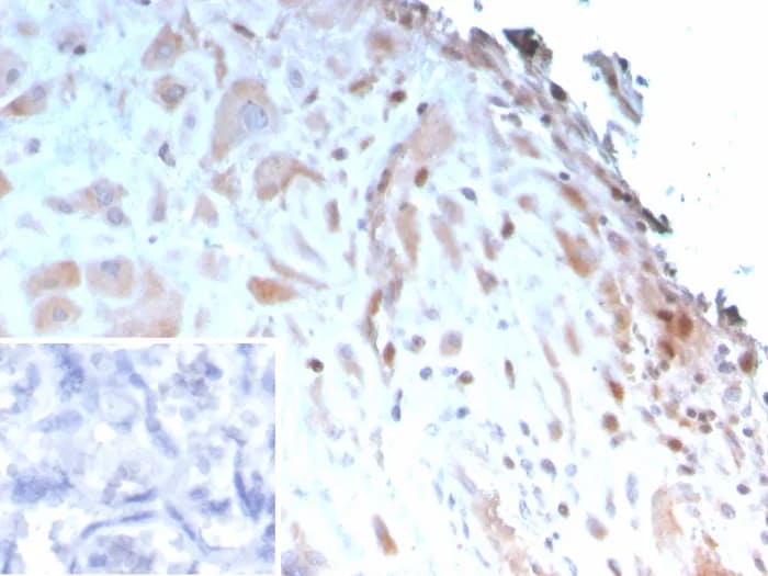 IGFBP-3 Antibody (IGFBP3/3423) Immunohistochemistry-Paraffin: IGFBP-3 Antibody (IGFBP3/3423) [NBP3-23802] -