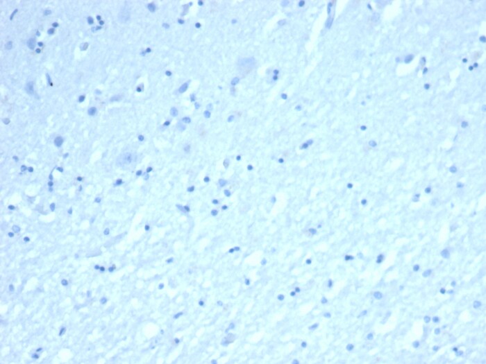 Inhibin alpha Antibody (INHA/8872R)