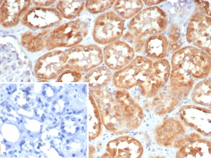BAD-LAMP/LAMP5 Antibody (LAMP5/7642)