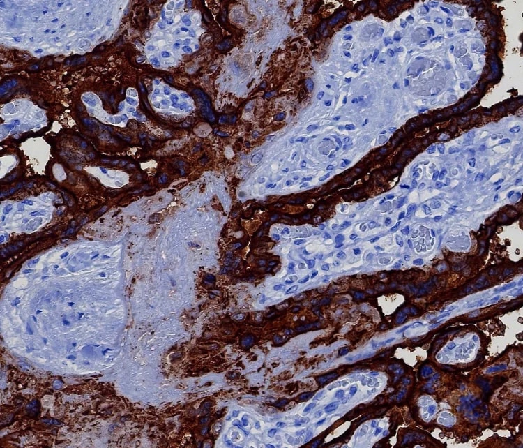 Alkaline Phosphatase/ALPP Antibody (ALPP/8112R) Immunohistochemistry-Paraffin: Alkaline Phosphatase/ALPP Antibody (ALPP/8112R) [NBP3-23813] -