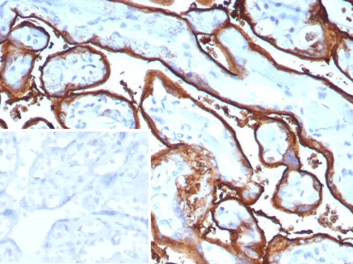 Alkaline Phosphatase/ALPP Antibody (ALPP/9109R) Immunohistochemistry-Paraffin: Alkaline Phosphatase/ALPP Antibody (ALPP/9109R) [NBP3-23814] -