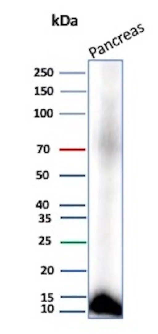 CLPS Antibody (CLPS/9021) Western Blot: CLPS Antibody (CLPS/9021) [NBP3-23815] -