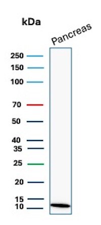 CLPS Antibody (CLPS/9021) Western Blot: CLPS Antibody (CLPS/9021) [NBP3-23815] -