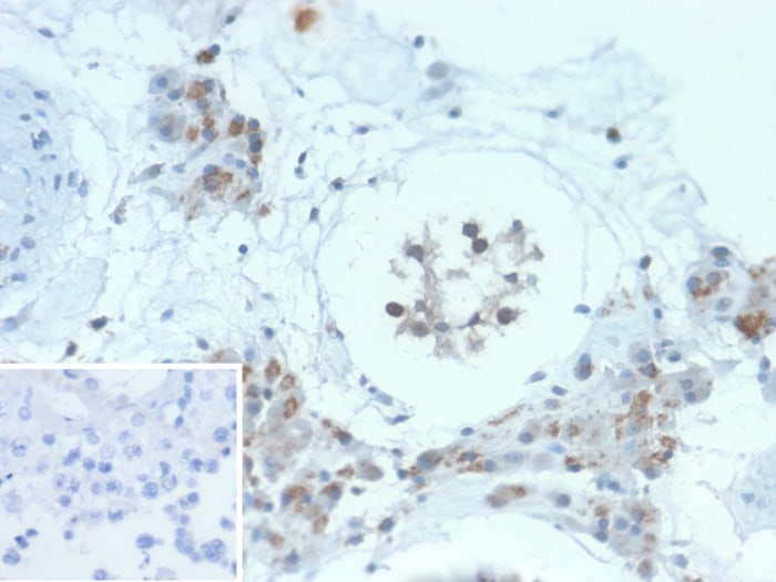 GCET2 Antibody (HGAL/2834)