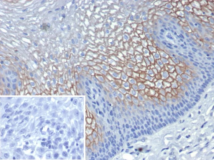 SBSN Antibody (SBSN/7961) Immunohistochemistry-Paraffin: SBSN Antibody (SBSN/7961) [NBP3-23822] -