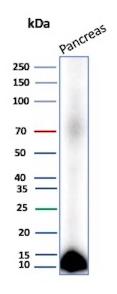 CLPS Antibody (CLPS/9026) Western Blot: CLPS Antibody (CLPS/9026) [NBP3-23823] -