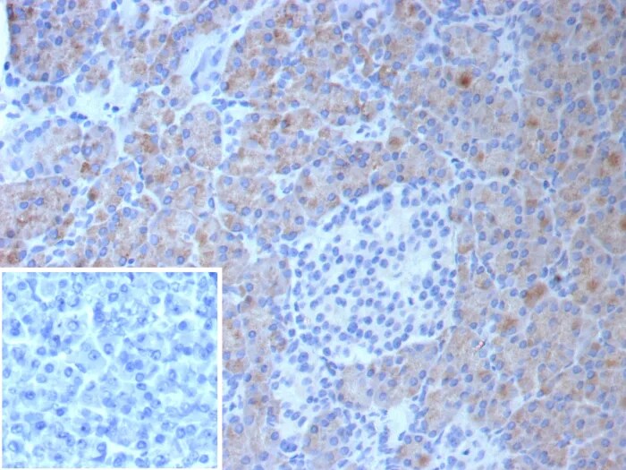 CLPS Antibody (CLPS/9027) Immunohistochemistry-Paraffin: CLPS Antibody (CLPS/9027) [NBP3-23824] -