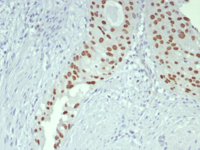 GATA-3 Antibody (GATA3/7686R) Immunohistochemistry-Paraffin: GATA-3 Antibody (GATA3/7686R) [NBP3-23826] -