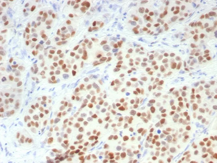 GATA-3 Antibody (GATA3/7686R) Immunohistochemistry-Paraffin: GATA-3 Antibody (GATA3/7686R) [NBP3-23826] -