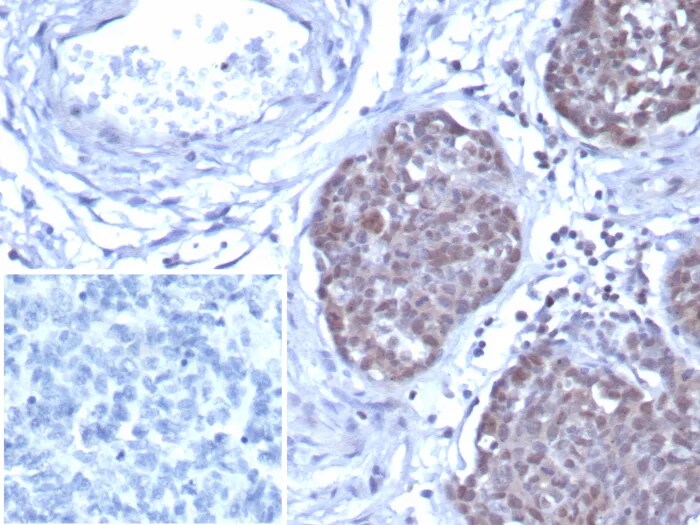 GATA-3 Antibody (GATA3/7686R) Immunohistochemistry-Paraffin: GATA-3 Antibody (GATA3/7686R) [NBP3-23826] -