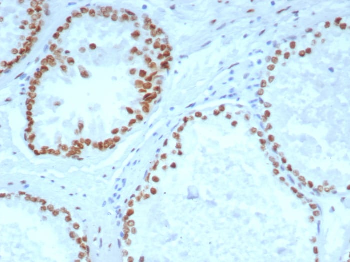 Androgen R/NR3C4 Antibody (DHTR/4929R)