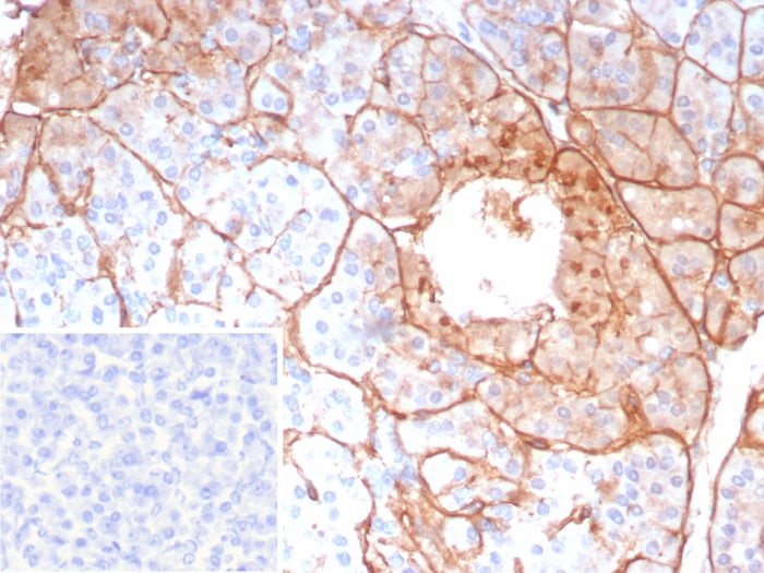 Collagen IV alpha5 Antibody (COL4A5/9396R)