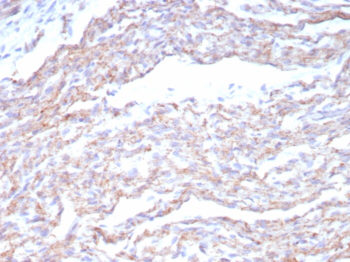 N-Cadherin Antibody (CDH2/8815R)