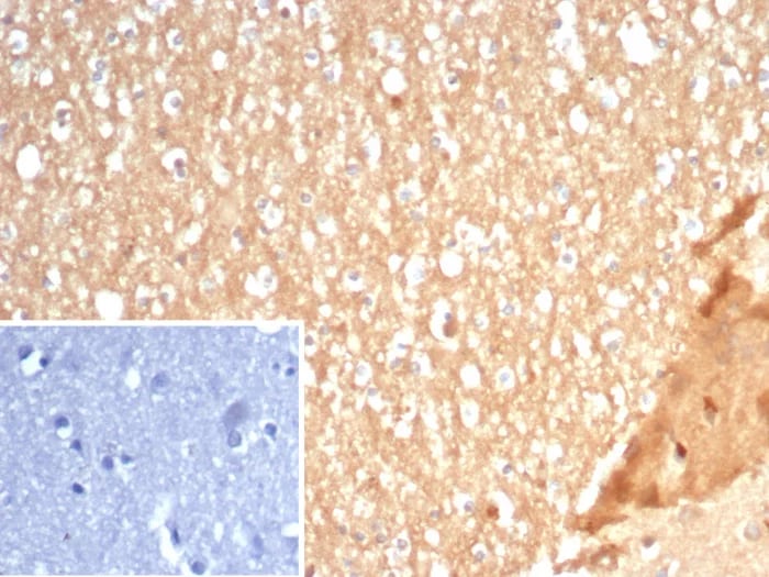 S100A5 Antibody (S100A5/7472) Immunohistochemistry-Paraffin: S100A5 Antibody (S100A5/7472) [NBP3-23844] -