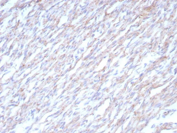 N-Cadherin Antibody (CDH2/8862R) Immunohistochemistry-Paraffin: N-Cadherin Antibody (CDH2/8862R) [NBP3-23845] -