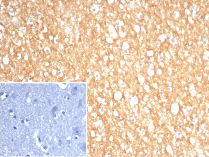 S100A5 Antibody (S100A5/7474)