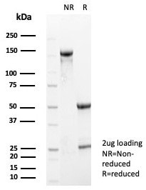 S100A5 Antibody (S100A5/7474)