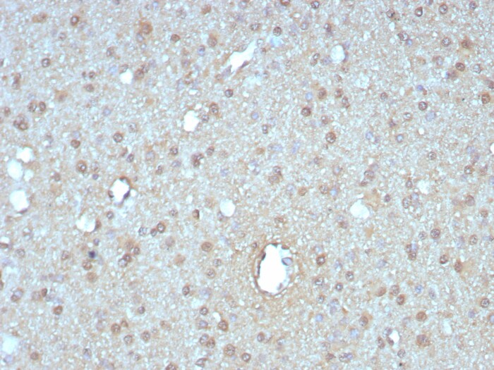 GIRK2 Antibody (KCNJ6/7558)