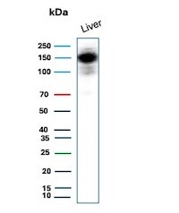 CPS1 Antibody (CPS1/9151R) Western Blot: CPS1 Antibody (CPS1/9151R) [NBP3-23855] -